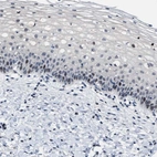 Immunohistochemical staining of human cervix, uterine shows moderate nuclear positivity in squamous epithelial cells.