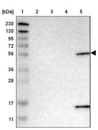 Lane 1: Marker [kDa] 230, 130, 95, 72, 56, 36, 28, 17, 11_br/_Lane 2: Human cell line RT-4_br/_Lane 3: Human cell line U-251MG sp_br/_Lane 4: Human plasma (IgG/HSA depleted)_br/_Lane 5: Human liver tissue