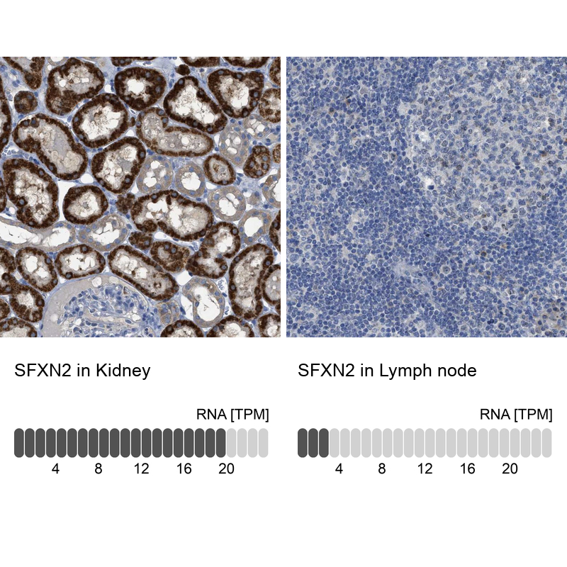 Anti-SFXN2 Antibody