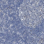 Immunohistochemical staining of human lymph node shows low expression as expected.