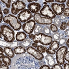 Immunohistochemical staining of human kidney shows high expression.