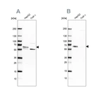 Western blot analysis using Anti-CDR2 antibody HPA018151 (A) shows similar pattern to independent antibody HPA023870 (B).