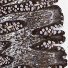 Immunohistochemical staining of human colon shows strong cytoplasmic positivity in glandular cells.