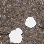 Immunohistochemical staining of human pancreas shows moderate cytoplasmic positivity in exocrine glandular cells.