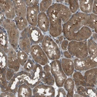 Immunohistochemical staining of human kidney shows moderate cytoplasmic positivity in cells in tubules.