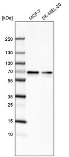 Western blot analysis in human cell line MCF-7 and human cell line SK-MEL-30.