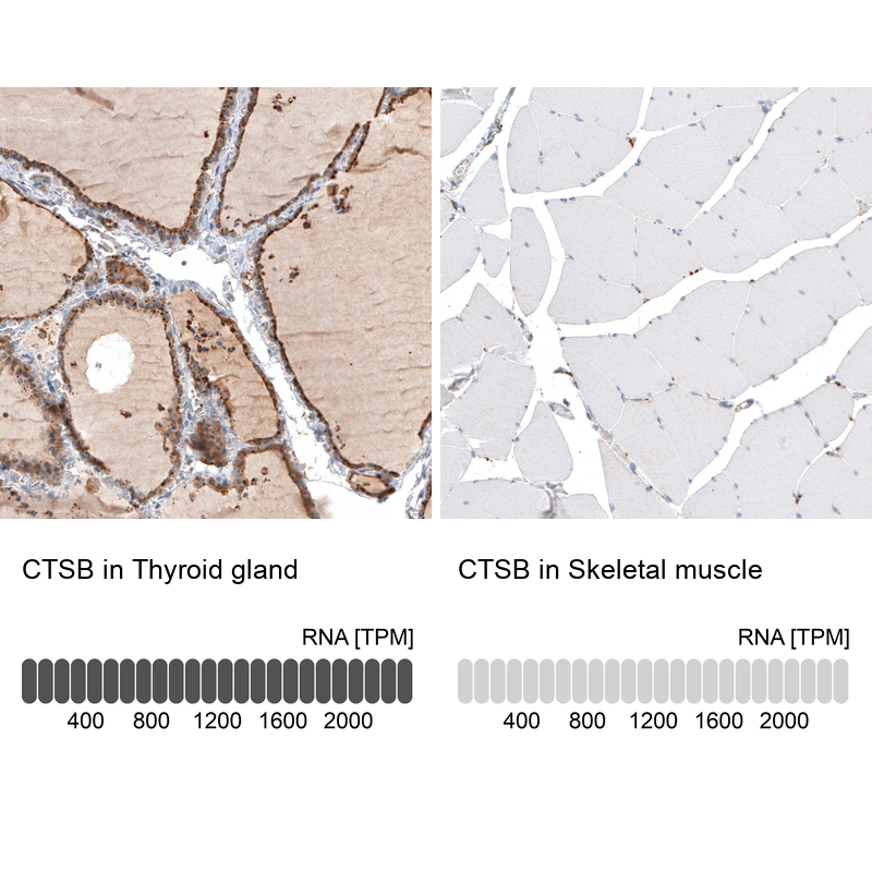 Anti-CTSB Antibody