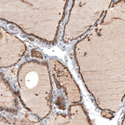 Immunohistochemical staining of human thyroid gland shows moderate granular cytoplasmic positivity in glandular cells.