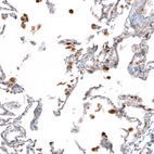 Immunohistochemical staining of human lung shows cytoplasmic positivity in macrophages.