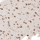 Immunohistochemical staining of human cerebral cortex shows granular cytoplasmic positivity in neuronal cells.