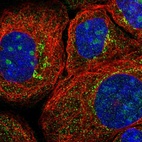 Immunofluorescent staining of human cell line A-431 shows localization to nucleoli & vesicles.