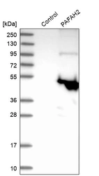 Western blot analysis in control (vector only transfected HEK293T lysate) and PAFAH2 over-expression lysate (Co-expressed with a C-terminal myc-DDK tag (~3.1 kDa) in mammalian HEK293T cells, LY424709).
