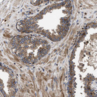 Immunohistochemical staining of human prostate shows moderate granular cytoplasmic positivity in glandular cells.