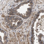 Immunohistochemical staining of human prostate shows moderate granular cytoplasmic positivity in glandular cells.