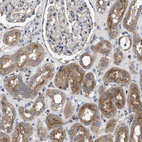 Immunohistochemical staining of human kidney shows moderate cytoplasmic positivity in cells in tubules.