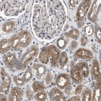 Immunohistochemical staining of human kidney shows moderate cytoplasmic positivity in cells in tubules.