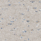 Immunohistochemical staining of human cerebral cortex shows weak positivity in nucleoli in neurons.