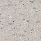 Immunohistochemical staining of human cerebral cortex shows weak positivity in nucleoli in neurons.
