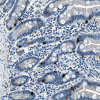 Immunohistochemical staining of human duodenum shows moderate nuclear positivity in glandular cells.