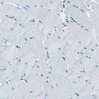 Immunohistochemical staining of human skeletal muscle shows no nucleoli positivity in monocytes.