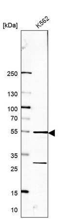 Western blot analysis in human cell line K562.