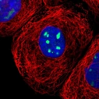 Immunofluorescent staining of human cell line A-431 shows localization to nucleoli.
