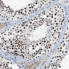 Immunohistochemical staining of human testis shows strong nuclear positivity in cells in seminiferous ducts.