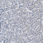 Immunohistochemical staining of human liver shows no nuclear positivity in hepatocytes as expected.