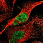 Immunofluorescent staining of human cell line U-2 OS shows localization to nucleoplasm.