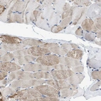 Immunohistochemical staining of human skeletal muscle shows weak to moderate cytoplasmic positivity in myocytes.
