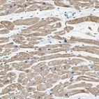 Immunohistochemical staining of human heart muscle shows moderate cytoplasmic positivity in cardiomyocytes.