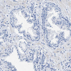Immunohistochemical staining of human prostate shows no positivity in glandular cells as expected.