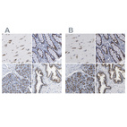 Anti-TMEM87A Antibody