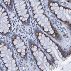 Anti-TMEM87A Antibody