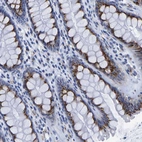 Immunohistochemical staining of human colon shows strong cytoplasmic granular positivity in glandular cells.