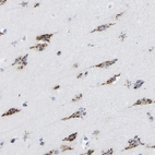 Immunohistochemical staining of human cerebral cortex shows strong cytoplasmic granular positivity in neurons.