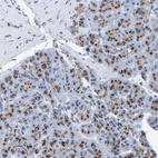 Anti-TMEM87A Antibody