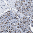 Immunohistochemical staining of human pancreas shows strong cytoplasmic granular positivity in exocrine glandular cells.