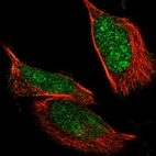 Immunofluorescent staining of human cell line U-251 MG shows localization to nucleus & nucleoli.