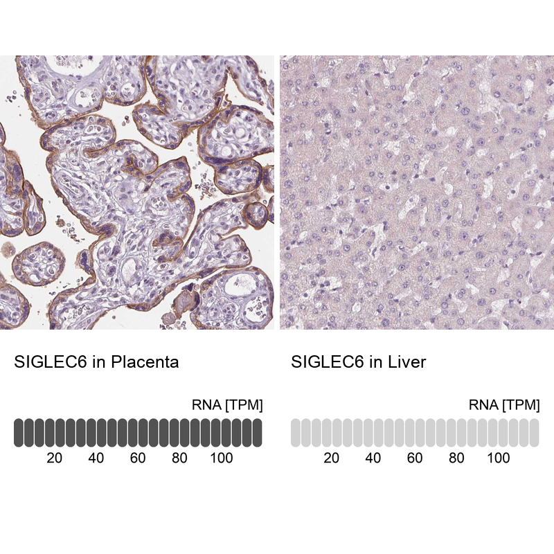 Anti-SIGLEC6 Antibody