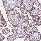 Immunohistochemical staining of human placenta shows moderate cytoplasmic and membranous positivity in trophoblastic cells.
