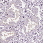 Anti-SIGLEC6 Antibody