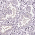 Immunohistochemical staining of human endometrium shows no positivity in glandular cells as expected.