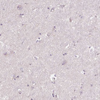 Immunohistochemical staining of human cerebral cortex shows no positivity in neurons as expected.