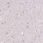 Immunohistochemical staining of human cerebral cortex shows no positivity in neurons as expected.
