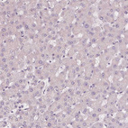 Anti-SIGLEC6 Antibody