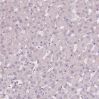 Immunohistochemical staining of human liver shows no positivity in hepatocytes as expected.