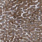 Anti-ILDR1 Antibody