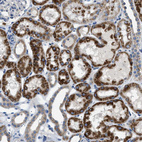 Anti-ILDR1 Antibody