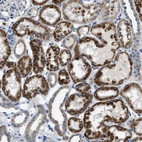 Immunohistochemical staining of human kidney shows strong cytoplasmic positivity in cells in tubules.